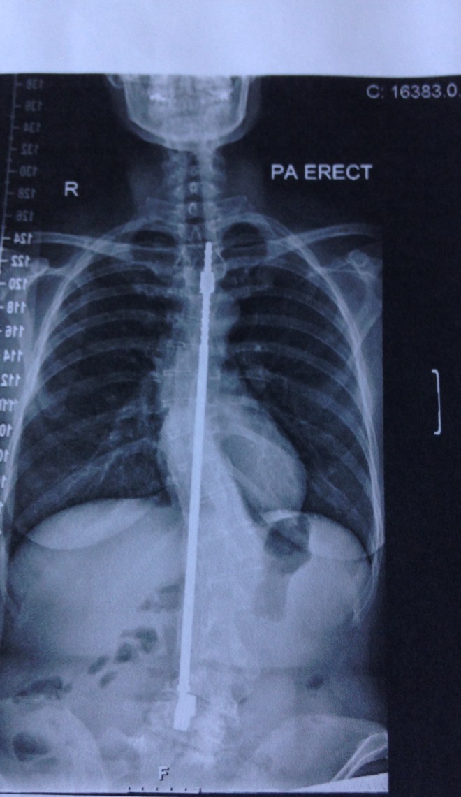 151113_141604-875795